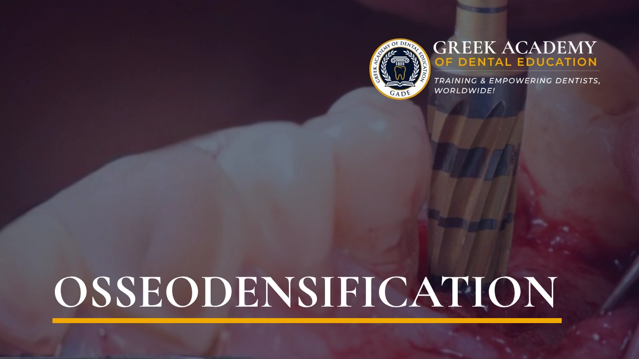 Osseodensification — An Innovative Drilling Technique