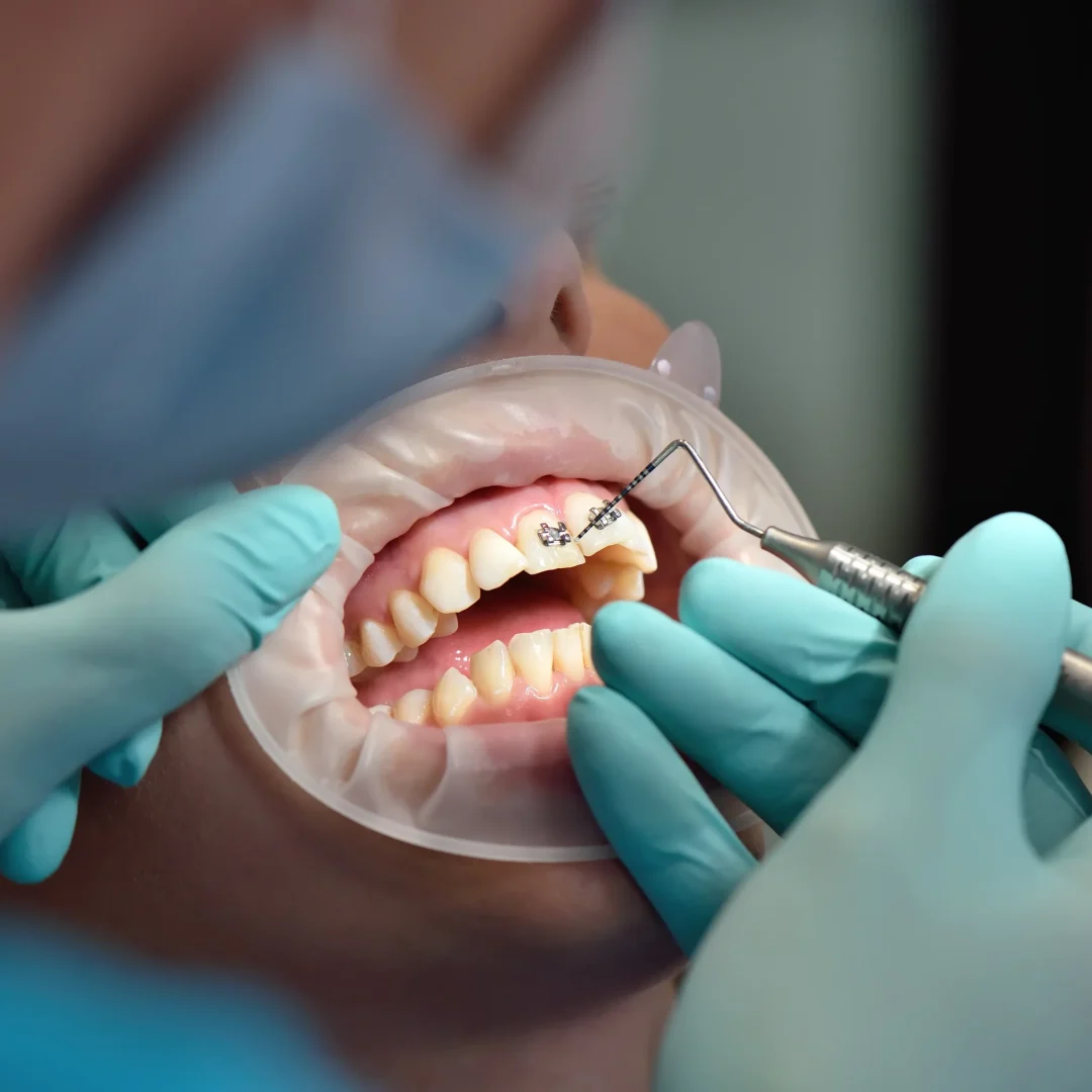 International dentists participating in continuing education and clinical training in Athens.